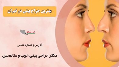 معرفی بهترین دکتر جراح بینی در تهران