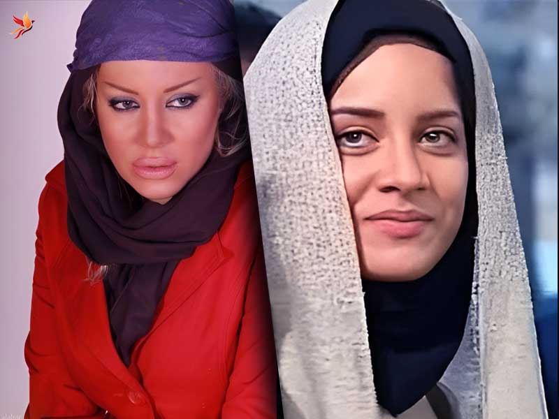 تغییر چهره شراره رخام قبل و بعد از تزریق ژل